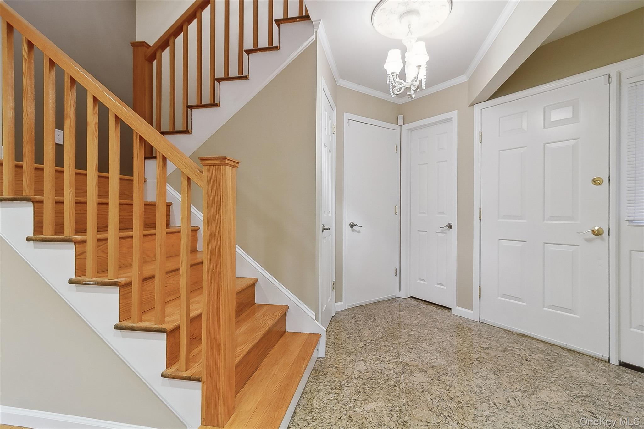 #3 photo, 51 Colby Lane, Briarcliff Manor , NY 10510