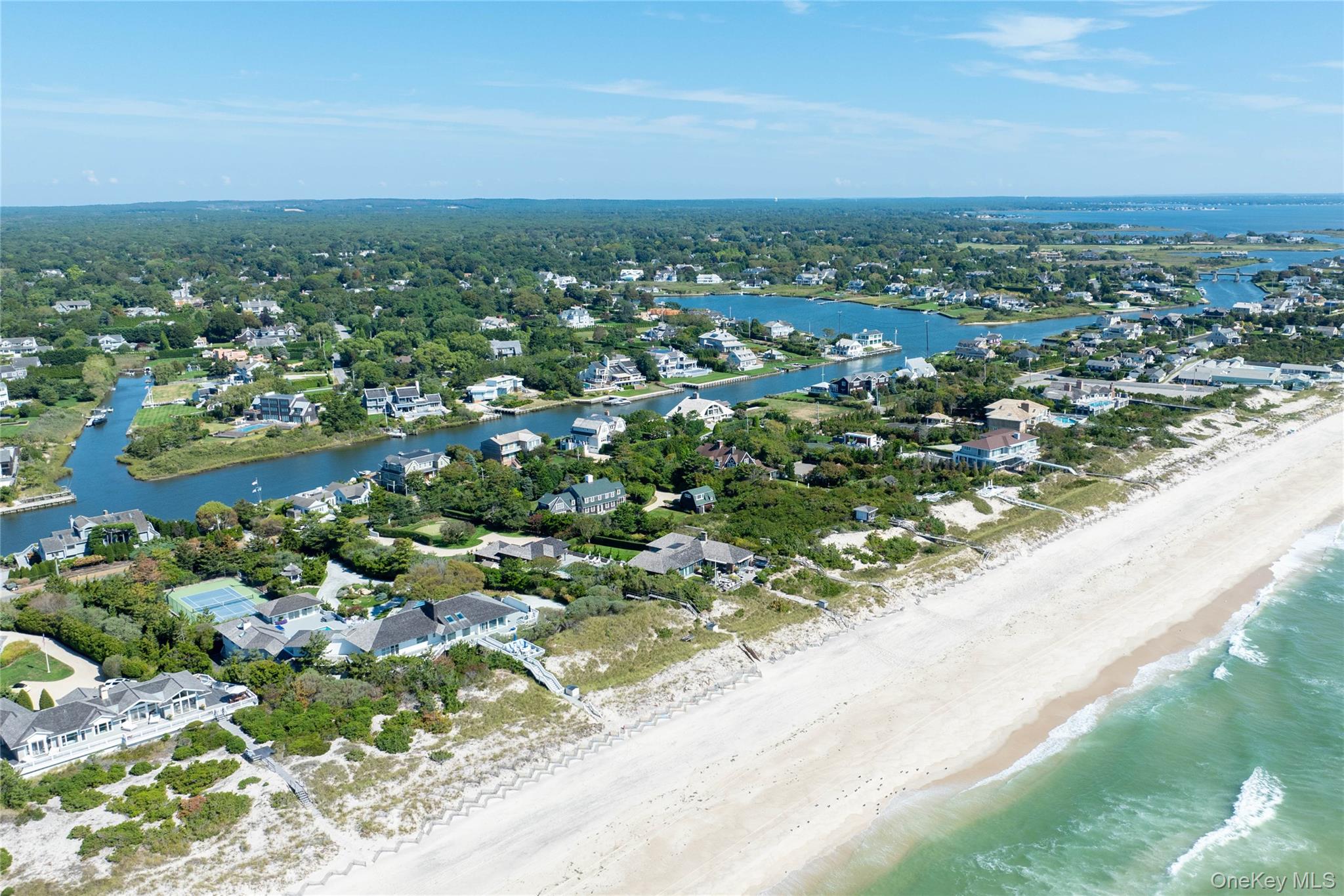 #5 photo, 39 Dune Road, サフォーク郡 Quogue , NY 11959