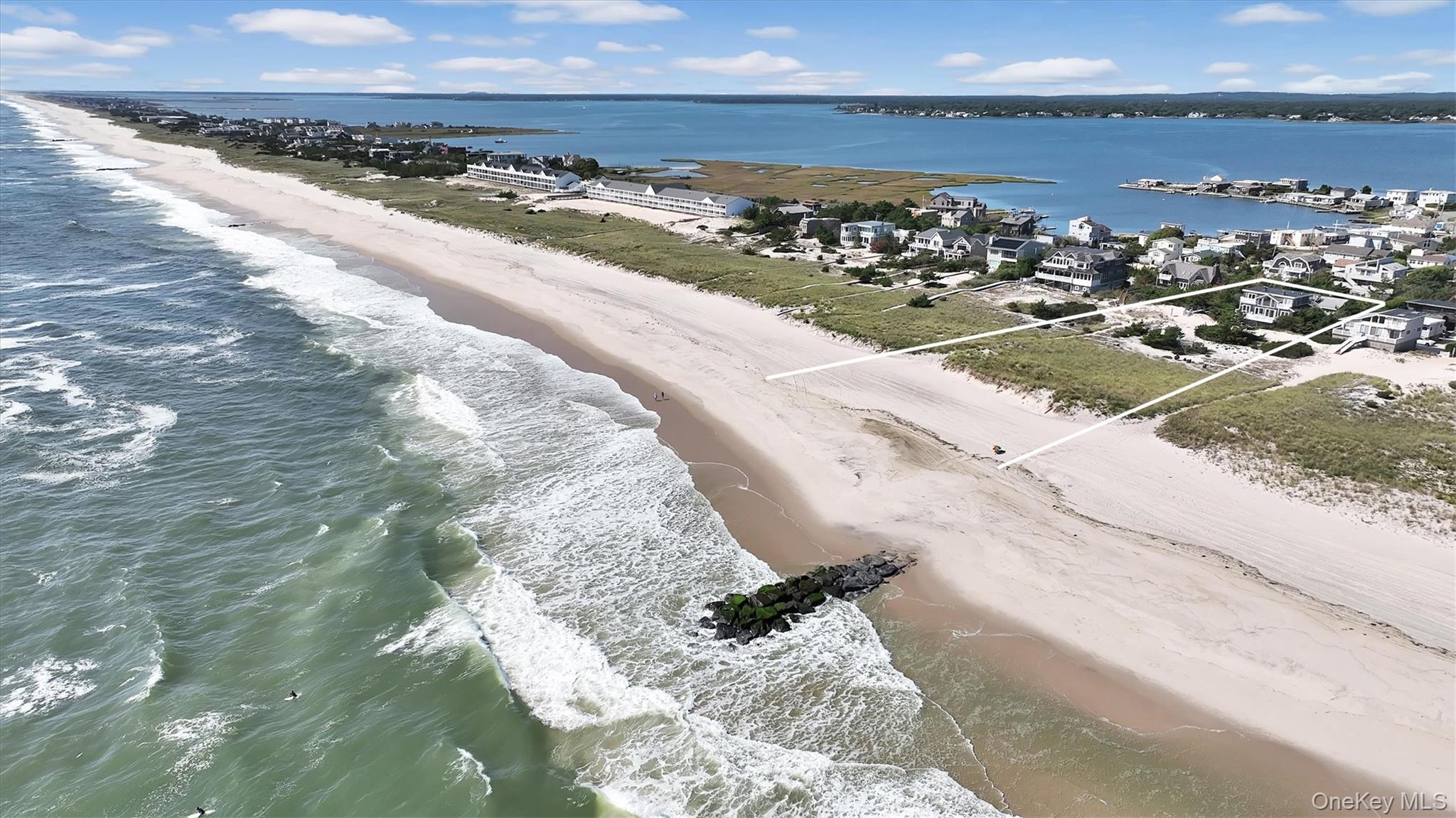 #4 photo, 431 Dune Road, サフォーク郡 Westhampton Beach , NY 11978