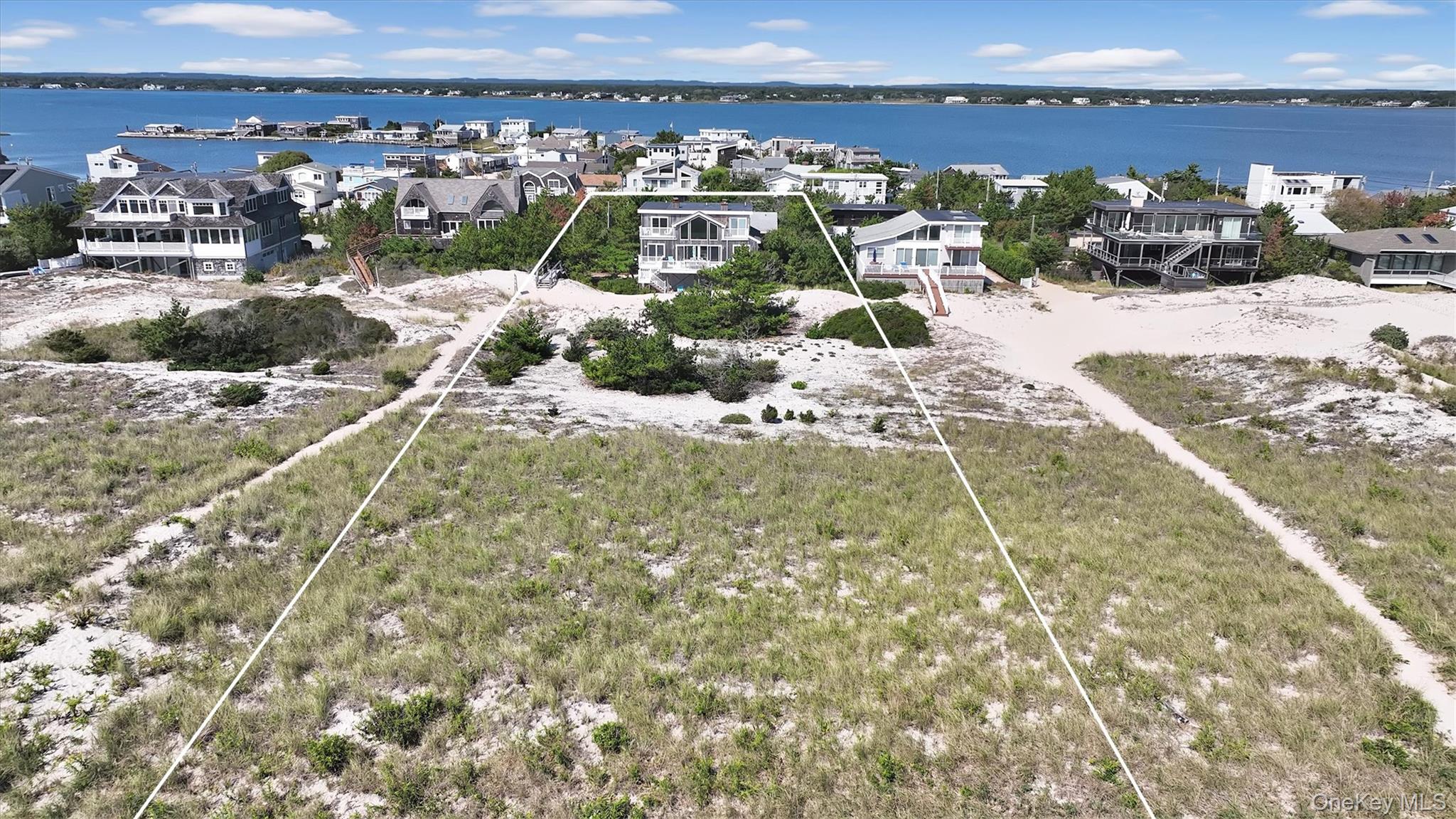 #6 photo, 431 Dune Road, サフォーク郡 Westhampton Beach , NY 11978