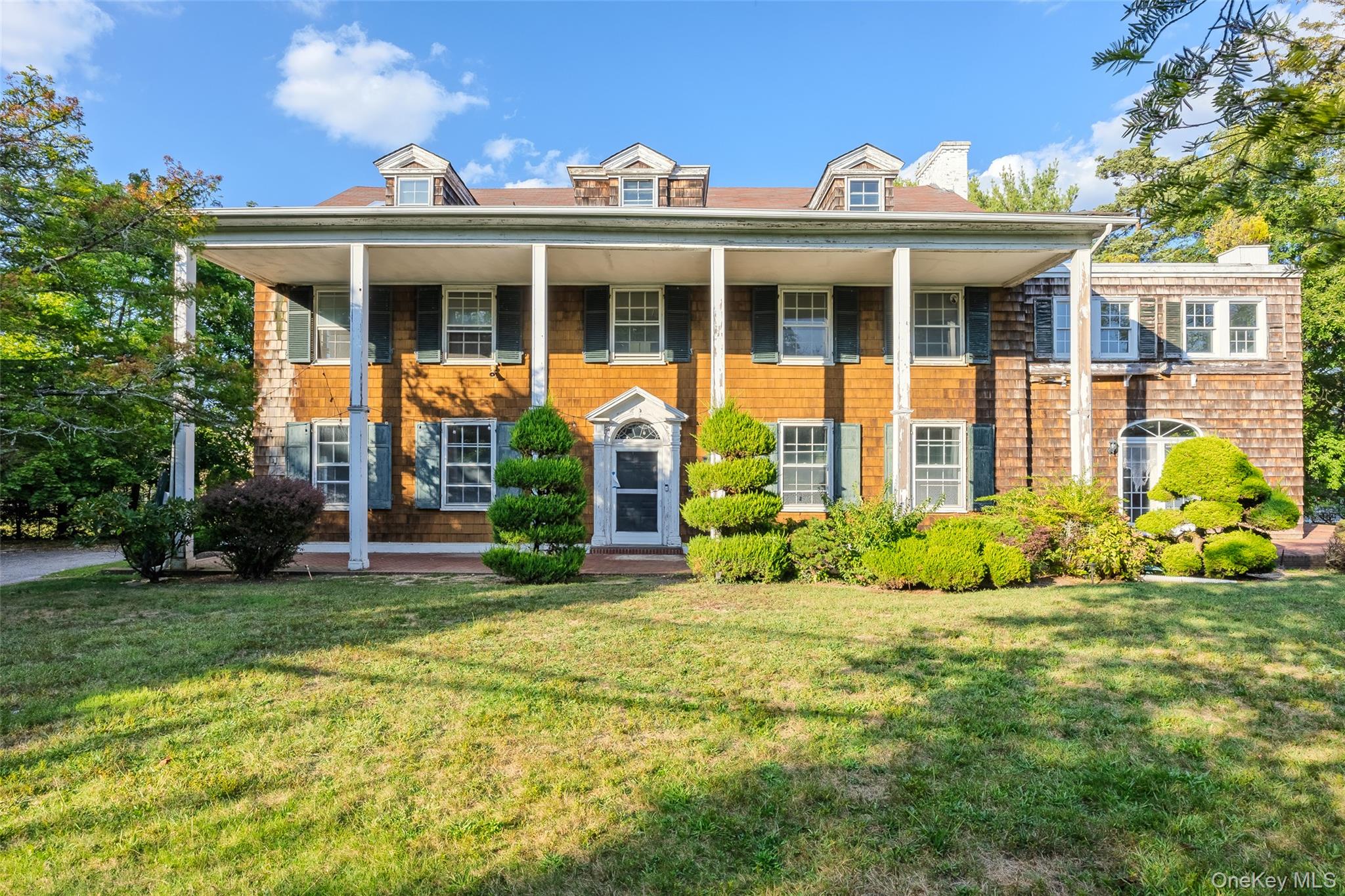 #3 photo, 175 Burton Lane, ナッソー郡 Lawrence , NY 11559