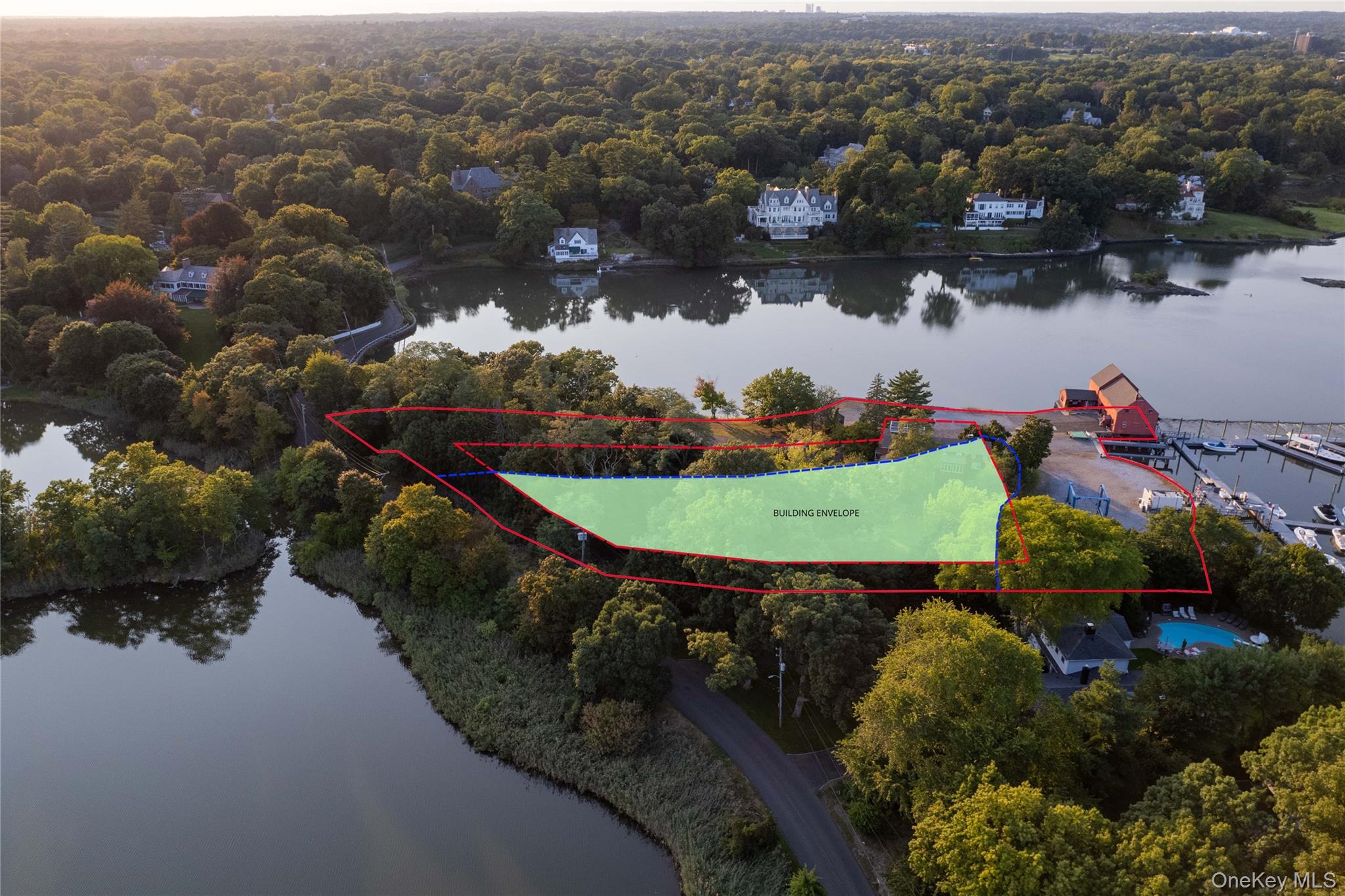 #3 photo, 191 Kirby Lane, Rye , NY 10580