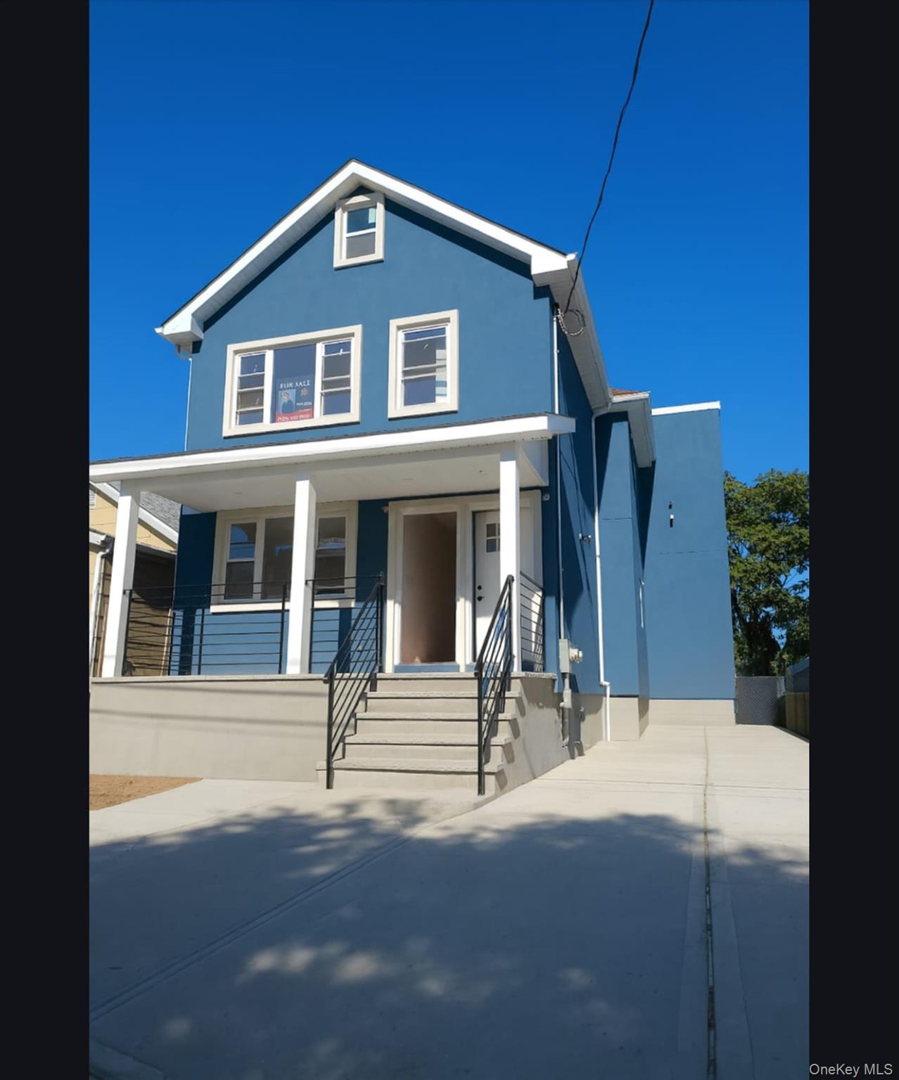 #1 photo, 1379 East 93, Brooklyn , NY 11236