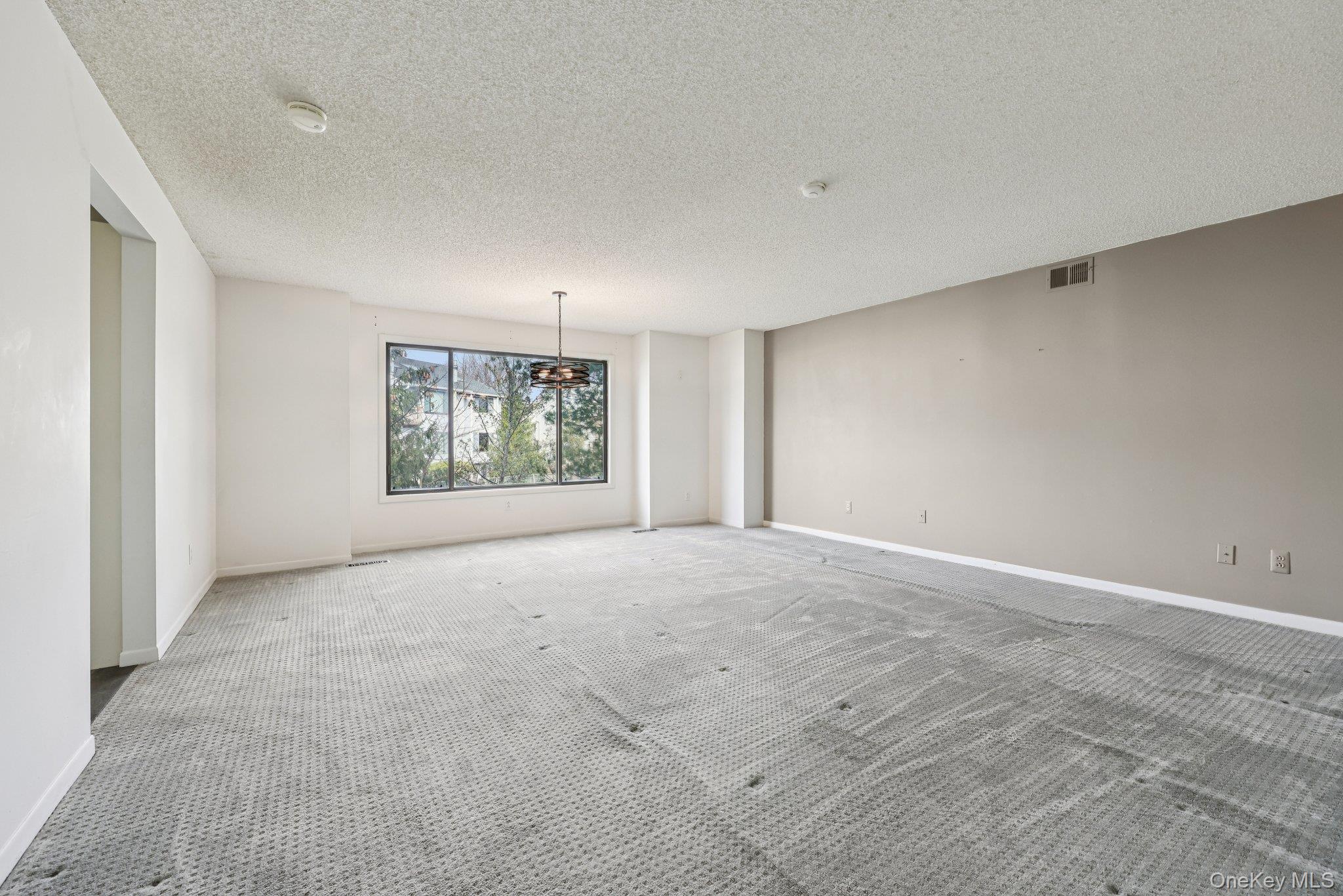 #4 photo, 34 Chester Lane, Nanuet , NY 10954