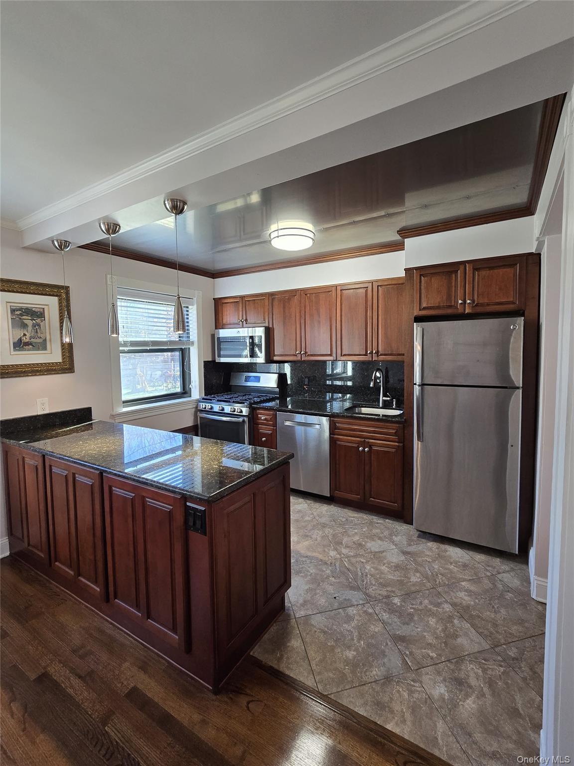 #3 photo, 155-27 81st Street, 皇后区 霍华德滩 Lindenwood , NY 11414