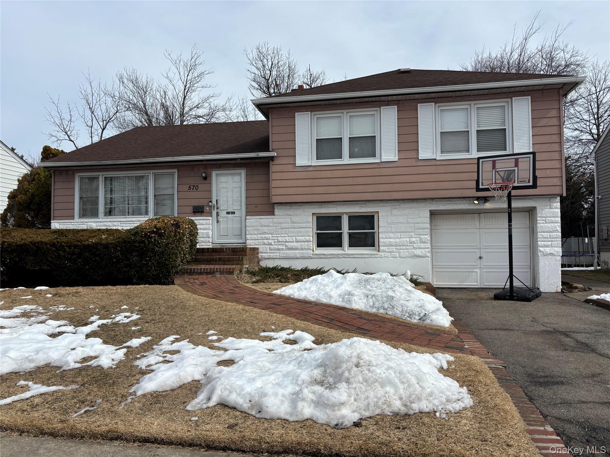 #1 photo, 570 Church Avenue, Woodmere , NY 11598