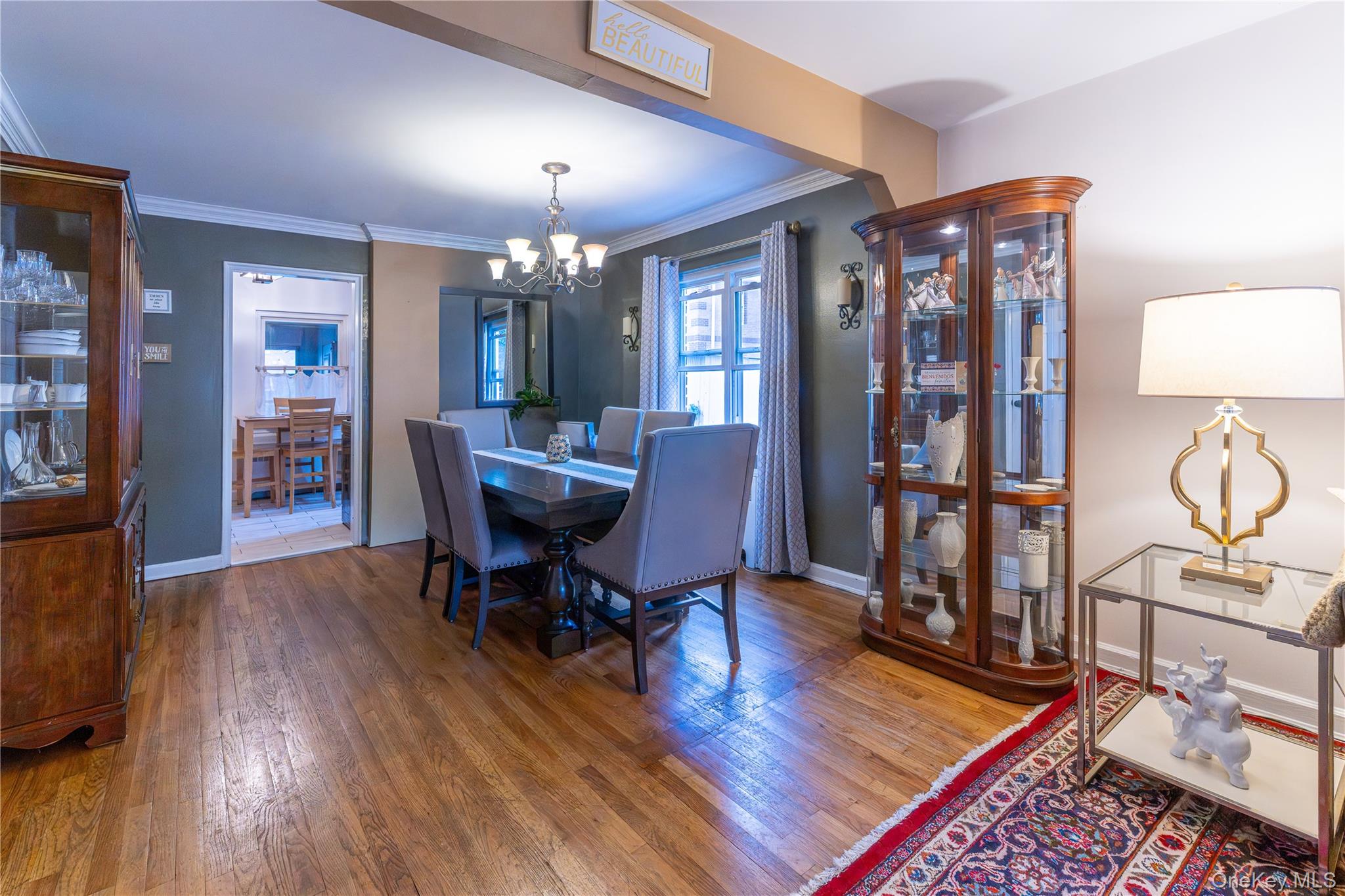 #5 photo, 2985 Young Avenue, ব্রঙ্কস Bronx , NY 10469